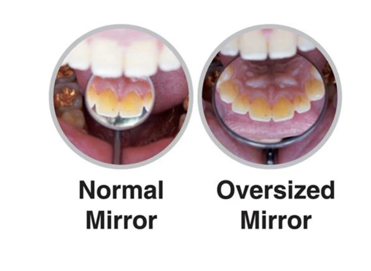 Gương khám🌱size lớn Osung Oversize Front Surface Mouth Mirror DMS39 GIÁ TỐT🌱NHA KHOA MALL🌱